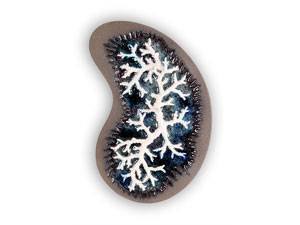 Alveoli corallini n.1